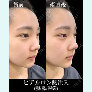症例