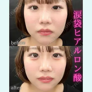 症例