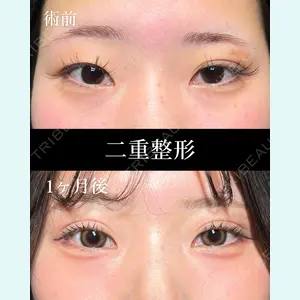 症例