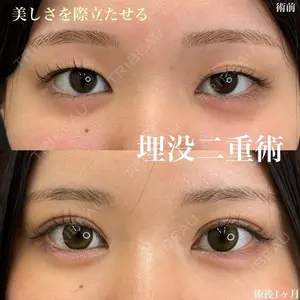 症例