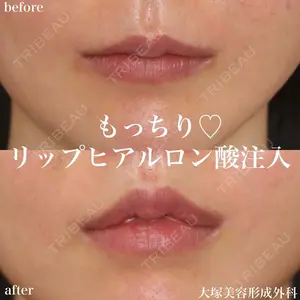 大塚美容形成外科 金沢院の症例