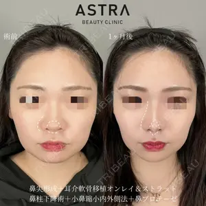 ASTRA BEAUTY CLINIC 塩満 惠子医師の症例
