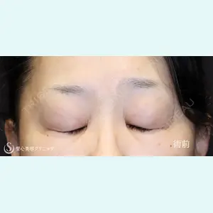 聖心美容クリニック 六本木院 川端 優也医師の症例