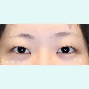 症例