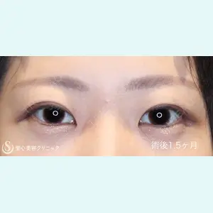 症例
