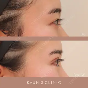 KAUNIS CLINIC（カウニスクリニック） 高野 敏郎医師の症例