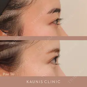 KAUNIS CLINIC（カウニスクリニック） 高野 敏郎医師の症例