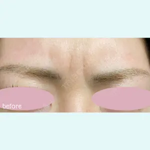 神戸スイミー皮膚科美容外科の症例