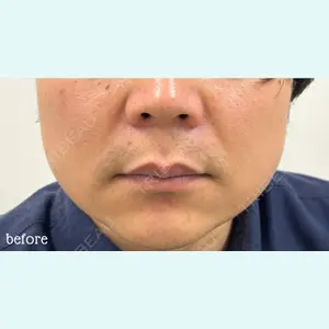 神戸スイミー皮膚科美容外科の症例