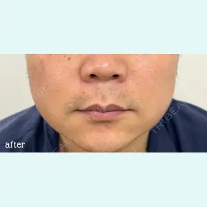 神戸スイミー皮膚科美容外科の症例