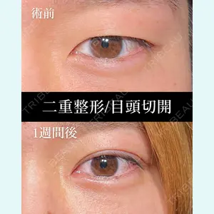 HAAB BEAUTY CLINIC 名古屋院 丸山 舜大医師の症例