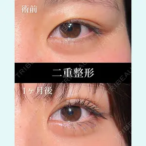 HAAB BEAUTY CLINIC 名古屋院 丸山 舜大医師の症例