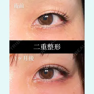 HAAB BEAUTY CLINIC 名古屋院 丸山 舜大医師の症例