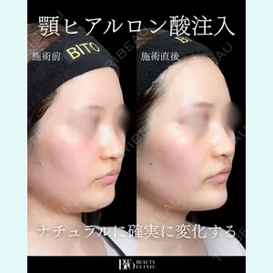 BITO BEAUTY CLINIC 伊藤 富良野医師の症例