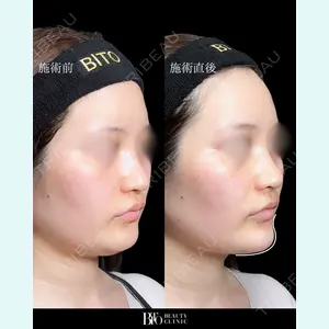 BITO BEAUTY CLINIC 伊藤 富良野医師の症例