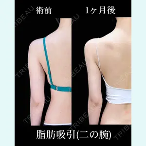 症例