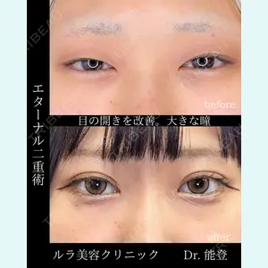 ルラ美容クリニック 札幌院 能登 貴弘医師の症例