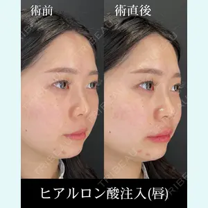 HAAB×DREAM BEAUTY CLINIC 大阪梅田院 柏木 太雅医師の症例
