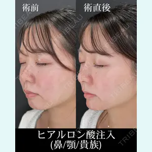 HAAB×DREAM BEAUTY CLINIC 大阪梅田院 柏木 太雅医師の症例