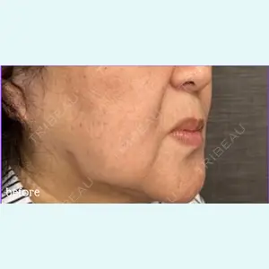 神戸スイミー皮膚科美容外科の症例