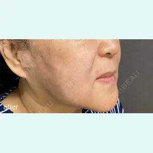 神戸スイミー皮膚科美容外科の症例