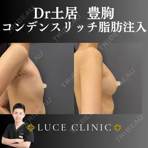 症例