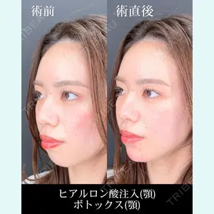 HAAB×DREAM BEAUTY CLINIC 大阪梅田院 錦 実奈医師の症例