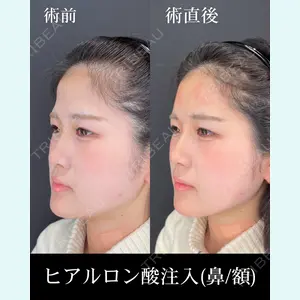 HAAB×DREAM BEAUTY CLINIC 大阪梅田院 錦 実奈医師の症例