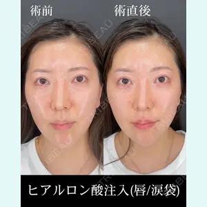 HAAB×DREAM BEAUTY CLINIC 大阪梅田院 錦 実奈医師の症例