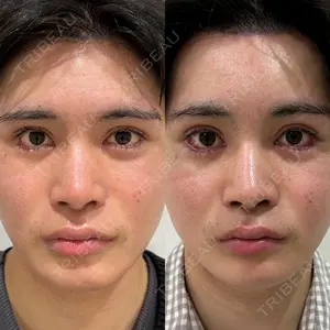 エターナル美容クリニックの症例