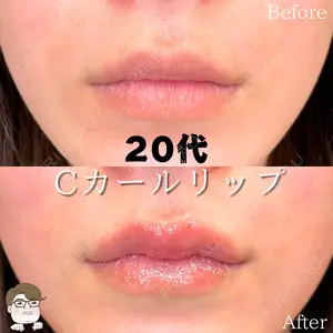 ルラ美容クリニック 札幌院 佐藤 雄紀医師の症例