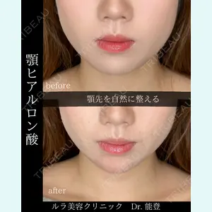 ルラ美容クリニック 札幌院 能登 貴弘医師の症例