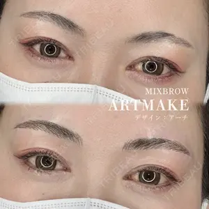 MEMOTO CLINIC 名古屋の症例