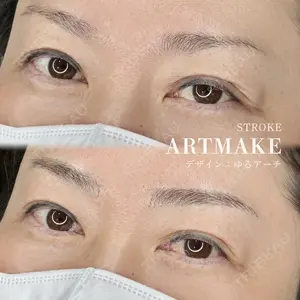MEMOTO CLINIC 名古屋の症例