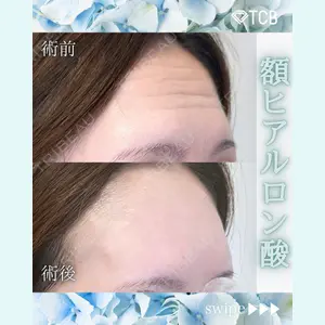 TCB東京中央美容外科 徳島院の症例