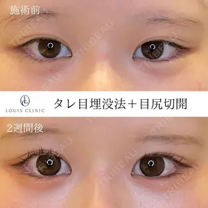 LOUIS CLINIC 二子玉川院【ルイクリニック】 小松 塁医師の症例