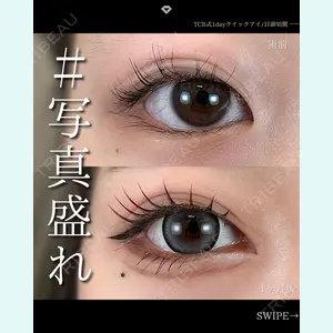 TCB東京中央美容外科 松山院の症例