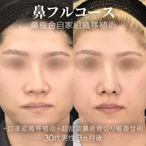 症例