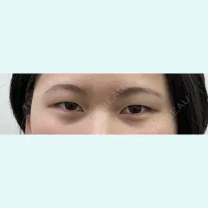 共立美容外科 千葉院 倉津　諭医師の症例
