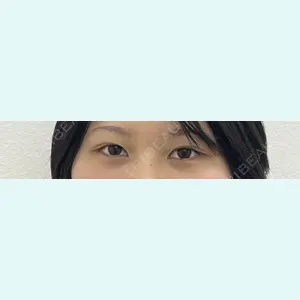 共立美容外科 千葉院 倉津　諭医師の症例