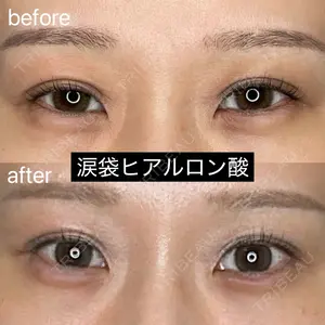 症例