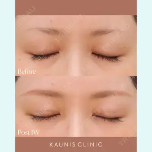 KAUNIS CLINIC（カウニスクリニック） 角　美帆医師の症例