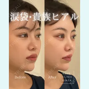 ROHE CLINIC GINZAの症例