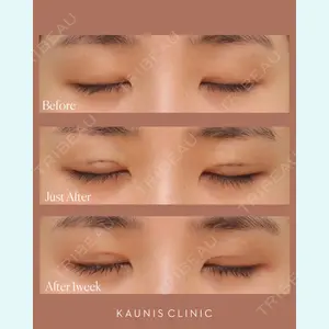 KAUNIS CLINIC（カウニスクリニック） 角　美帆医師の症例