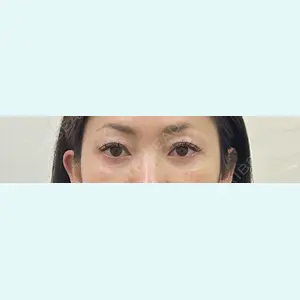 共立美容外科 千葉院 倉津　諭医師の症例
