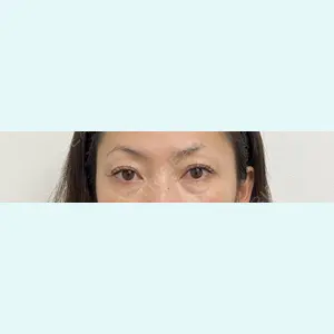 共立美容外科 千葉院 倉津　諭医師の症例
