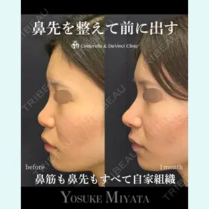 シンデレラ＆ダヴィンチクリニック 宮田 洋佑医師の症例