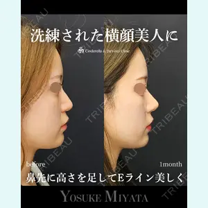 シンデレラ＆ダヴィンチクリニック 宮田 洋佑医師の症例