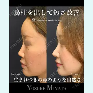 シンデレラ＆ダヴィンチクリニック 宮田 洋佑医師の症例
