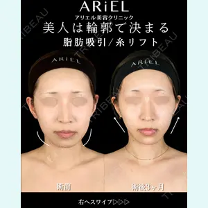 症例
